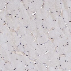 Tight Junction Protein 1 Antibody, Novus Biologicals:Antibodies:Primary