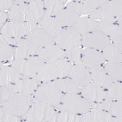 Tight Junction Protein 1 Antibody, Novus Biologicals 0.1mL; Unlabeled:Antibodies,