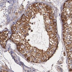 Tight Junction Protein 1 Antibody, Novus Biologicals 0.1mL; Unlabeled:Antibodies,