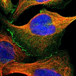 Tight Junction Protein 2 Antibody, Novus Biologicals 0.1mL; Unlabeled:Antibodies,