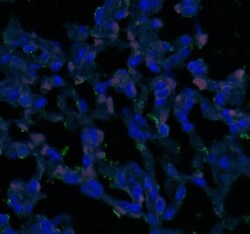 Tight Junction Protein 2 Antibody, Novus Biologicals 0.1mL; Unlabeled:Antibodies,