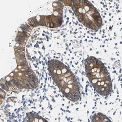 Tight Junction Protein 2 Antibody, Novus Biologicals 0.1mL; Unlabeled:Antibodies,
