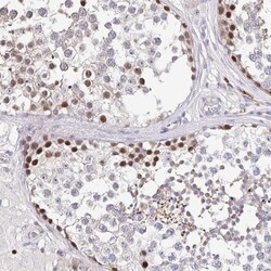 Timeless Antibody, Novus Biologicals 0.1mL; Unlabeled:Antibodies, Polyclonal