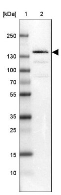 Timeless Antibody, Novus Biologicals 0.1mL; Unlabeled:Antibodies, Polyclonal