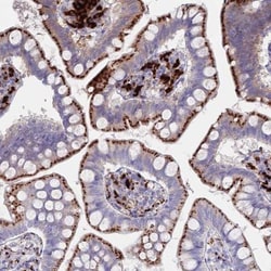 Tissue alpha-L-Fucosidase/FUCA1 Antibody, Novus Biologicals:Antibodies:Primary