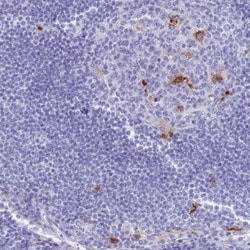 Tissue alpha-L-Fucosidase/FUCA1 Antibody, Novus Biologicals:Antibodies:Primary