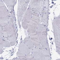 Tissue alpha-L-Fucosidase/FUCA1 Antibody, Novus Biologicals:Antibodies:Primary