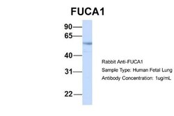 Tissue alpha-L-Fucosidase/FUCA1 Antibody, Novus Biologicals 100&mu;L; Unlabeled:Antibodies,