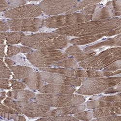 Titin Antibody, Novus Biologicals 25 &mu;L; Unlabeled:Antibodies, Polyclonal