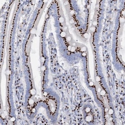 Tm9sf3 Antibody, Novus Biologicals 25ul | Buy Online | Novus Biologicals | Fisher Scientific