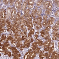 Tmp21/p23 Antibody, Novus Biologicals:Antibodies:Primary Antibodies