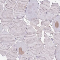 Tmp21/p23 Antibody, Novus Biologicals:Antibodies:Primary Antibodies