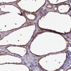 Tmp21/p23 Antibody, Novus Biologicals:Antibodies:Primary Antibodies