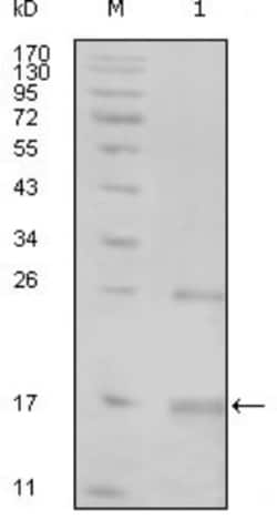Tnk1 Antibody (1B5G3), Novus Biologicals:Antibodies:Primary Antibodies