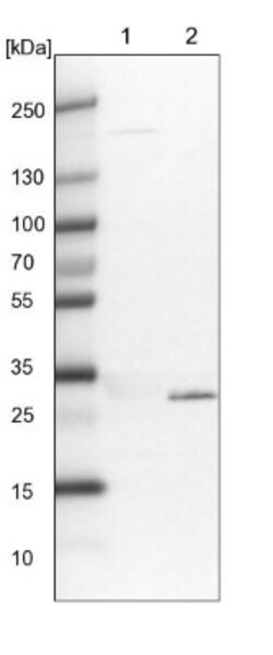 Tollip Antibody, Novus Biologicals:Antibodies:Primary Antibodies