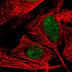Topoisomerase I Antibody, Novus Biologicals 0.1mL; Unlabeled:Antibodies,