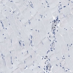 Topoisomerase I Antibody, Novus Biologicals 0.1mL; Unlabeled:Antibodies,