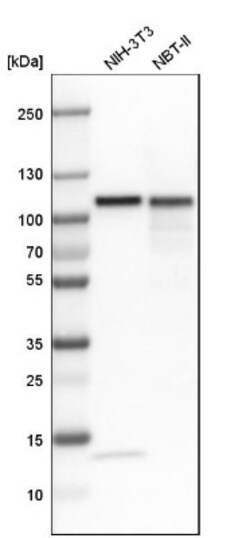 Topoisomerase I Antibody, Novus Biologicals 0.1mL; Unlabeled:Antibodies,