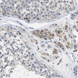 Torsin 1B Antibody, Novus Biologicals 0.1mL; Unlabeled:Antibodies, Polyclonal