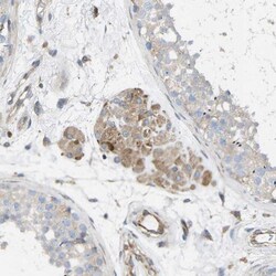 Torsin 1B Antibody, Novus Biologicals 0.1mL; Unlabeled:Antibodies, Polyclonal