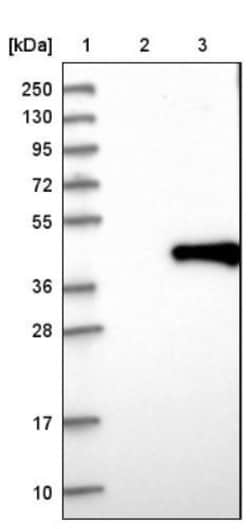 Torsin 1B Antibody, Novus Biologicals 0.1mL; Unlabeled:Antibodies, Polyclonal