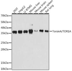Torsin A Rabbit anti-Human, Mouse, Rat, Clone: 4Q2I9, Novus Biologicals