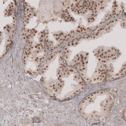 anti-Transcription factor E3, Polyclonal, Novus Biologicals 0.1mL; Unlabeled:Antibodies,