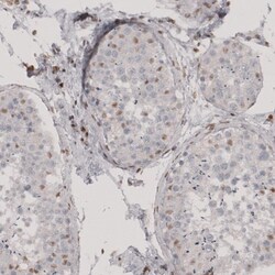anti-Transcription factor E3, Polyclonal, Novus Biologicals 0.1mL; Unlabeled:Antibodies,