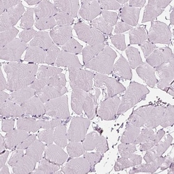 Transferrin Antibody, Novus Biologicals 25 &mu;L; Unlabeled:Antibodies,