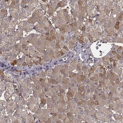 Transferrin Antibody, Novus Biologicals 25 &mu;L; Unlabeled:Antibodies,