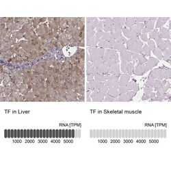 Transferrin Antibody, Novus Biologicals 25 &mu;L; Unlabeled:Antibodies,