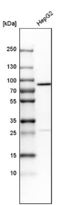 Transferrin Antibody, Novus Biologicals 25 &mu;L; Unlabeled:Antibodies,
