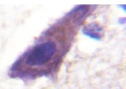 TfR (Transferrin R) Antibody - BSA Free, Novus Biologicals 0.1 mL | Buy Online | Novus Biologicals | Fisher Scientific