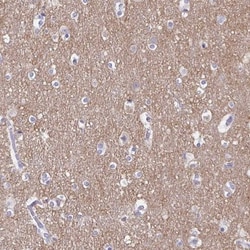 Transgelin-3 Antibody, Novus Biologicals 0.1mL; Unlabeled:Antibodies, Polyclonal