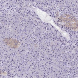 Transgelin-3 Antibody, Novus Biologicals 0.1mL; Unlabeled:Antibodies, Polyclonal