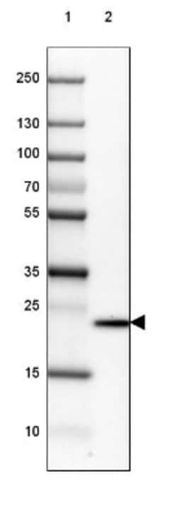 Transgelin-3 Antibody, Novus Biologicals 0.1mL; Unlabeled:Antibodies, Polyclonal