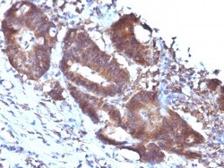 Transgelin/TAGLN/SM22 alpha Antibody (TAGLN/247), Novus Biologicals 0.2mg;