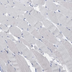 Transgelin/TAGLN/SM22 alpha Antibody, Novus Biologicals 25 &mu;L | Buy Online | Novus Biologicals | Fisher Scientific