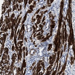 Transgelin/TAGLN/SM22 alpha Antibody, Novus Biologicals 25 &mu;L | Buy Online | Novus Biologicals | Fisher Scientific