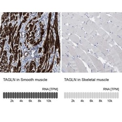 Transgelin/TAGLN/SM22 alpha Antibody, Novus Biologicals 25 &mu;L | Buy Online | Novus Biologicals | Fisher Scientific