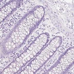 Transglutaminase 1/TGM1 Antibody, Novus Biologicals 0.1mL; Unlabeled:Antibodies,