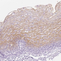 Transglutaminase 1/TGM1 Antibody, Novus Biologicals 0.1mL; Unlabeled:Antibodies,