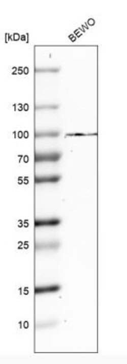 Transglutaminase 1/TGM1 Antibody, Novus Biologicals 0.1mL; Unlabeled:Antibodies,