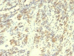 Transglutaminase 2/TGM2 Antibody (TGM2/419), Novus Biologicals 0.2mg; Unlabeled:Antibodies,