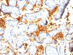 Transglutaminase 2/TGM2 Antibody (TGM2/419), Novus Biologicals 0.2mg; Unlabeled:Antibodies,