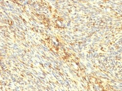 Transglutaminase 2/TGM2 Antibody (TGM2/419), Novus Biologicals 0.2mg; Unlabeled:Antibodies,