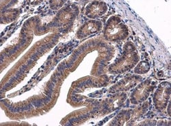 Transglutaminase 2/TGM2 Antibody, Novus Biologicals 0.1mL; Unlabeled:Antibodies,