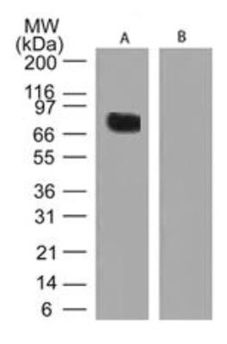 Transglutaminase 2/TGM2 Antibody, Novus Biologicals:Antibodies:Primary