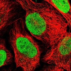 Transketolase Antibody, Novus Biologicals 0.1mL; Unlabeled:Antibodies,