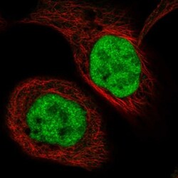 Transketolase Antibody, Novus Biologicals 25 &mu;L; Unlabeled:Antibodies,